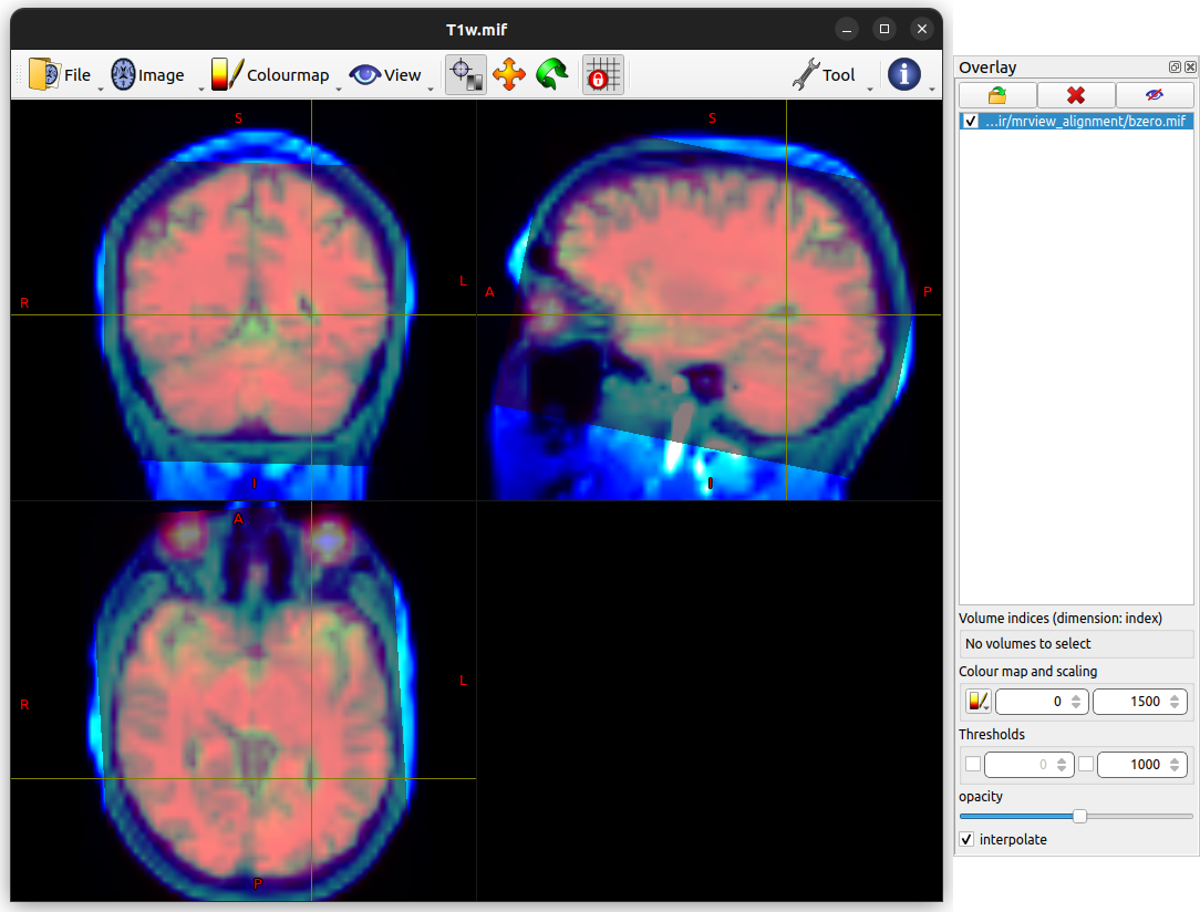 MRView using the Overlay tool to assess image alignment